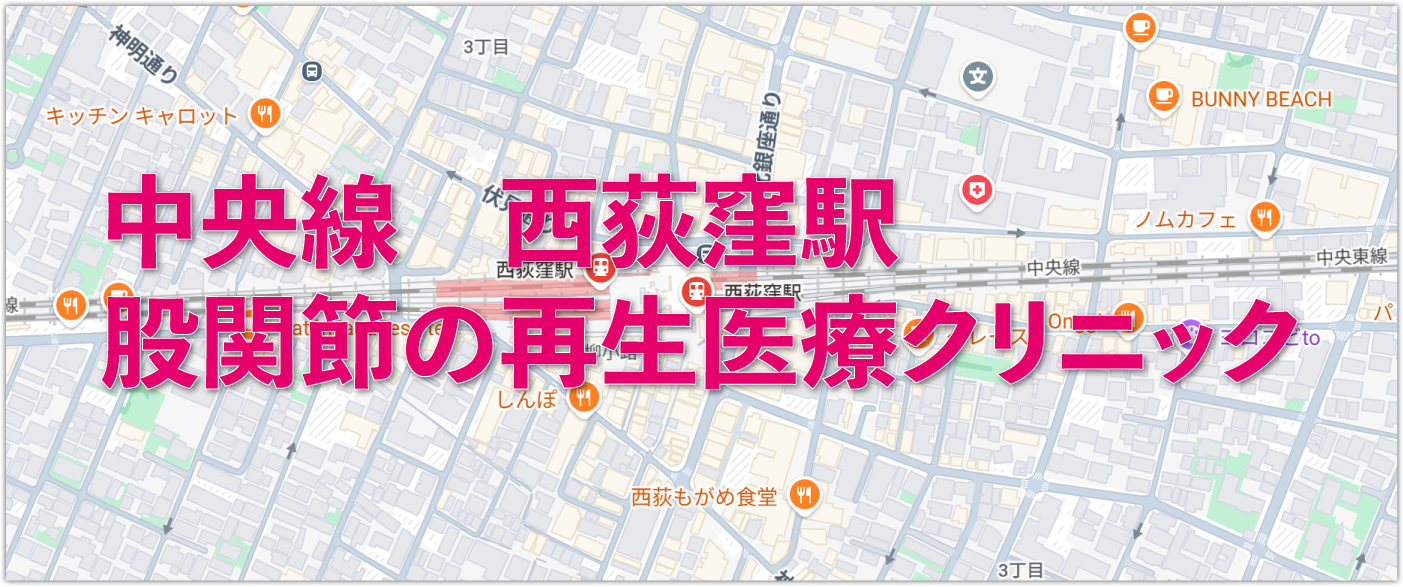 JR中央線西荻窪駅周辺の股関節の再生医療クリニック