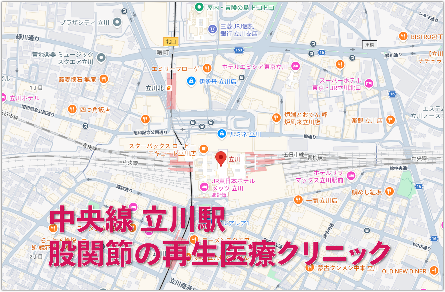 JR中央線立川駅周辺の股関節の再生医療クリニック